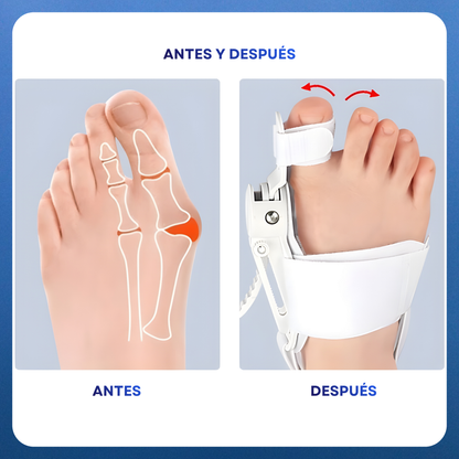 Comfylia™ ToeRelief Corrector