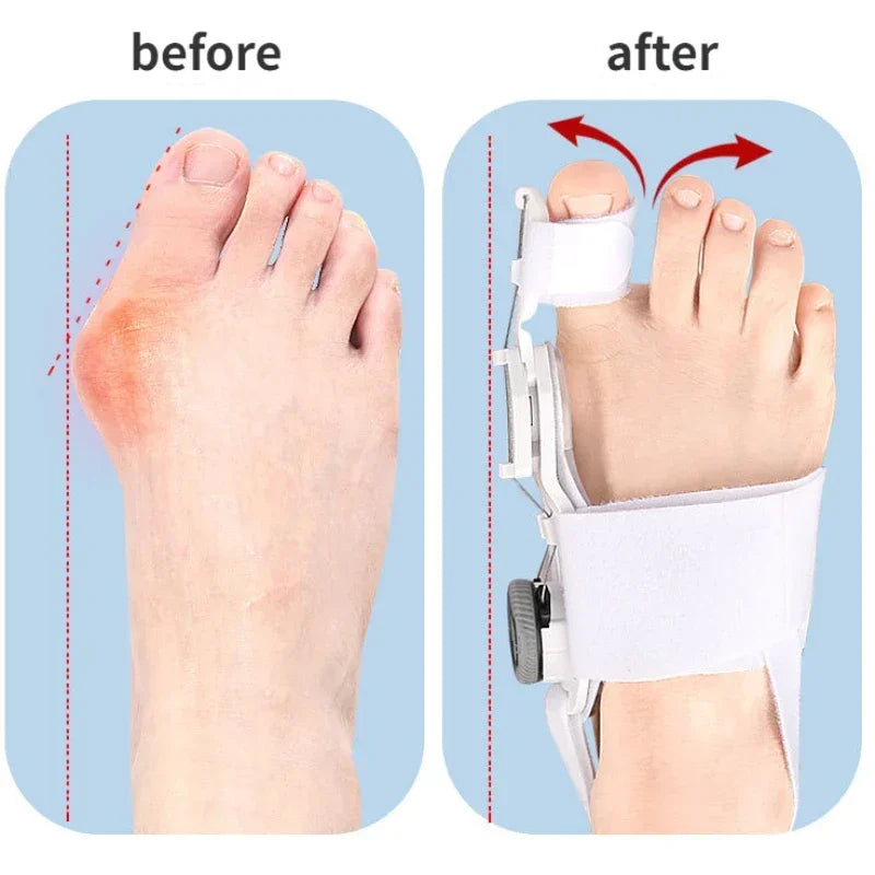 Comfylia™ ToeRelief Corrector